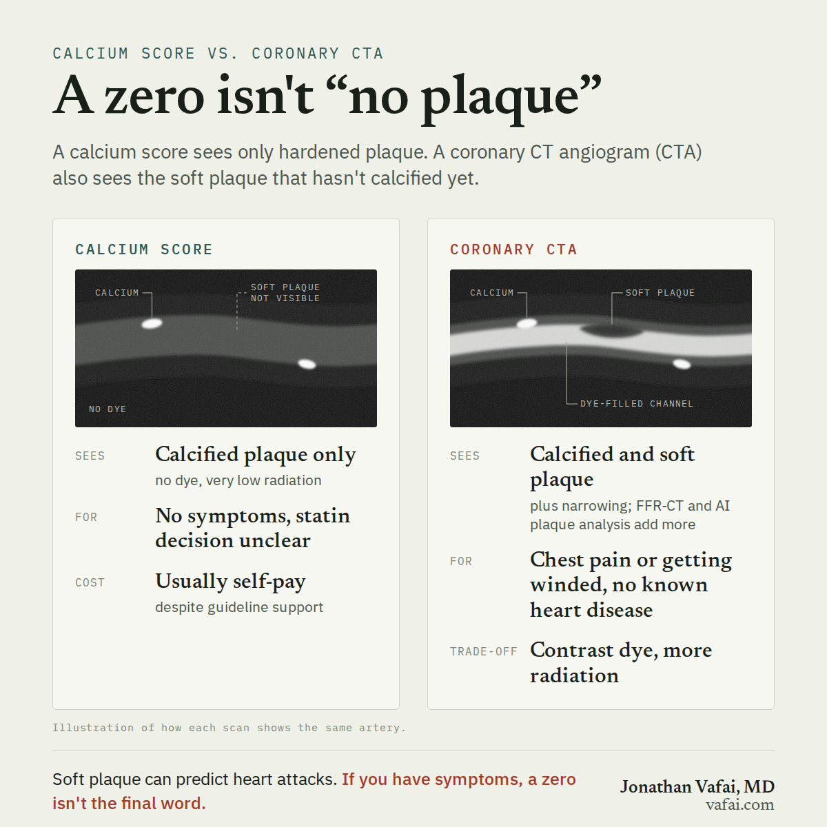 Soft Plaque vs. Calcium: What a Coronary CTA Sees That a Calcium Score Can't
